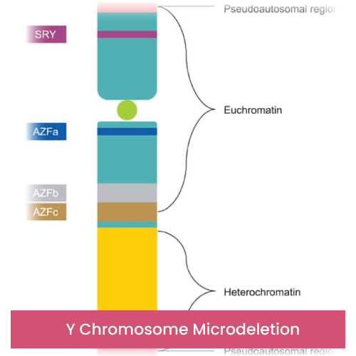 Y Chromosome Microdeletion