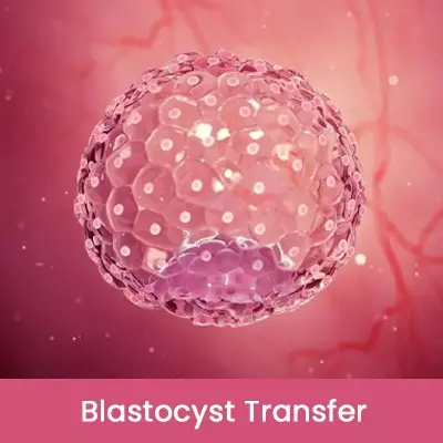 Blastocyst Transfer