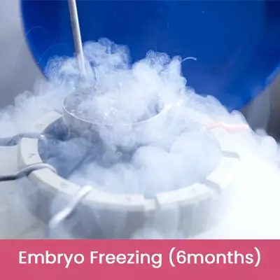 Embryo Freezing 6 months