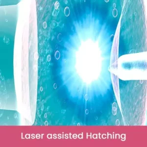 Laser assisted Hatching
