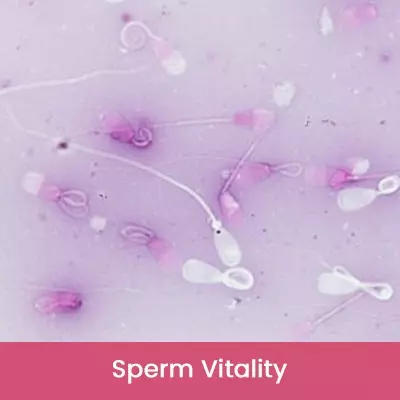 Sperm Vitality