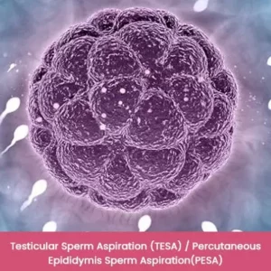 Testicular Sperm Aspiration TESA