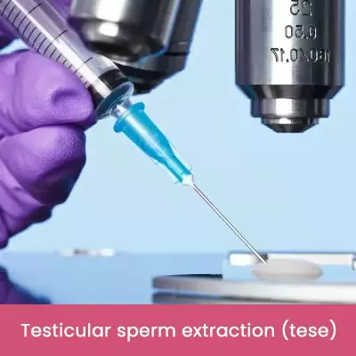 Testicular sperm extraction tese