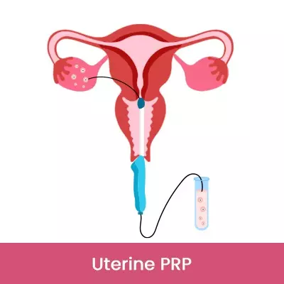 Uterine PRP