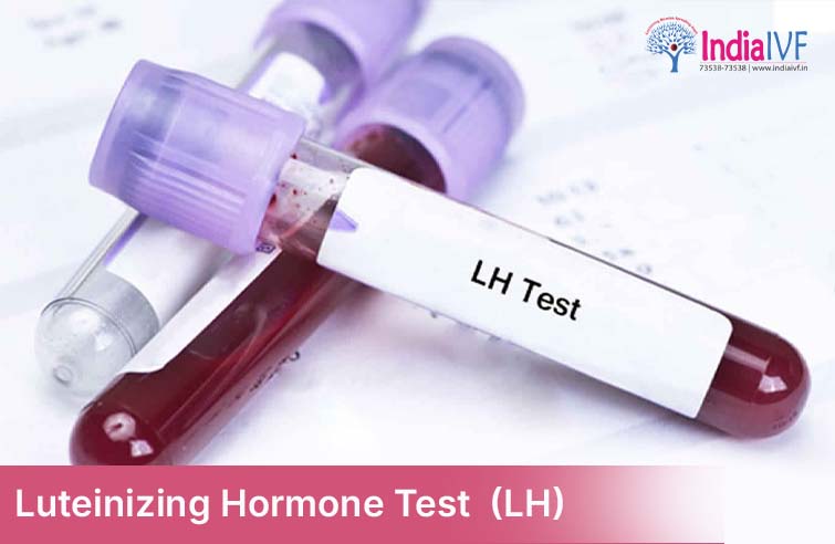 Urinary-Luteinizing-Hormone-LH